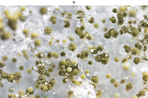 microscopic germs